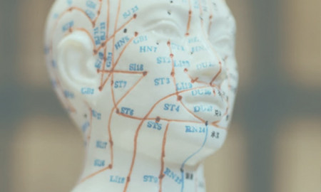 Image for post IRG - Ballard Acupuncture Program