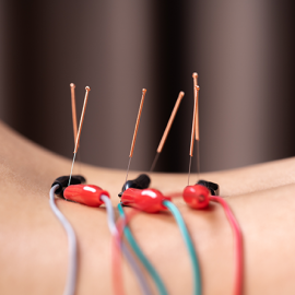 Image for Service - Dry Needling